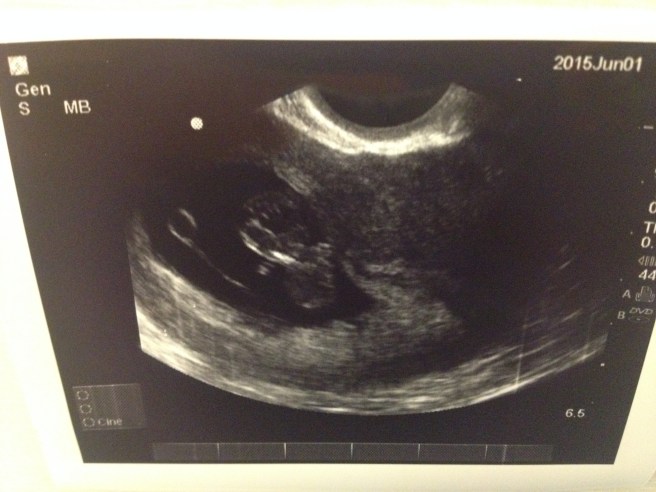 Player to Be Named Later